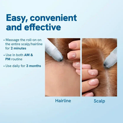 Advanced Hair Growth Roll-On Serum with Rosemary Oil and Peptide Complex