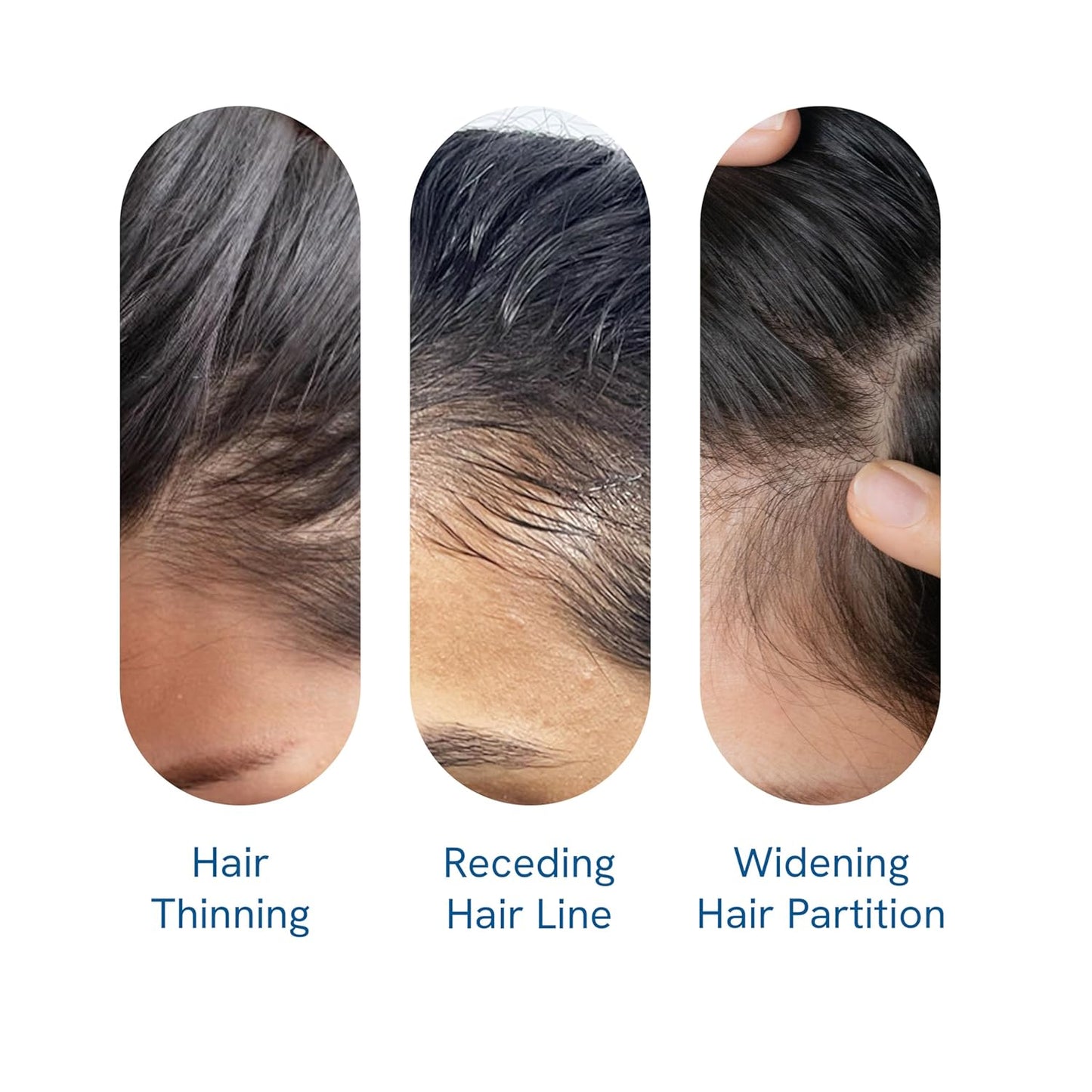 Advanced Hair Growth Roll-On Serum with Rosemary Oil and Peptide Complex