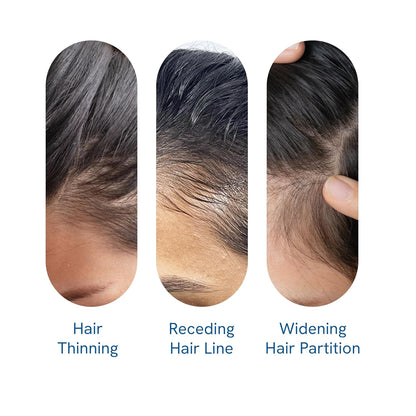 Advanced Hair Growth Roll-On Serum with Rosemary Oil and Peptide Complex